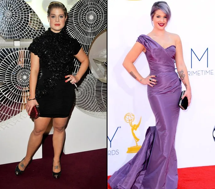 Bild von Sharon Osbourne, vor und nach ihrem Gewichtsverlust.